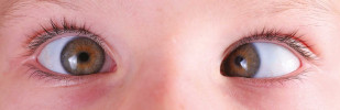 3M okluzory Opticlude Mini B&G 30